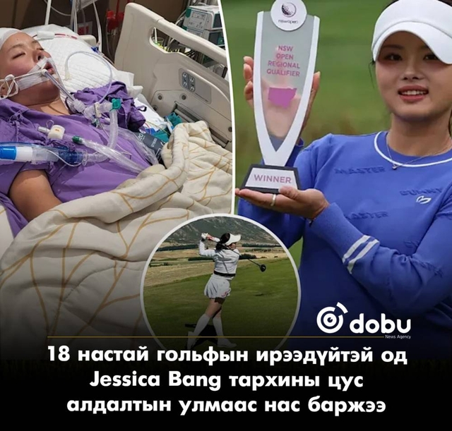 18 настай гольфын ирээдүйтэй од Jessica Bang тархины цус алдалтын улмаас нас баржээ