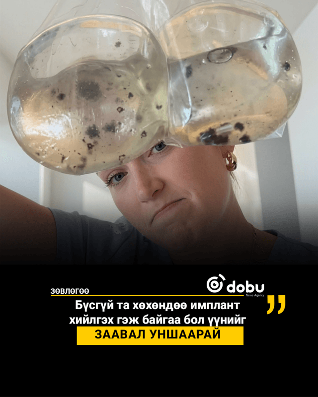 ЗӨВЛӨГӨӨ: Бүсгүй та хөхөндөө имплант  хийлгэх гэж байгаа бол үүнийг  заавал уншаарай