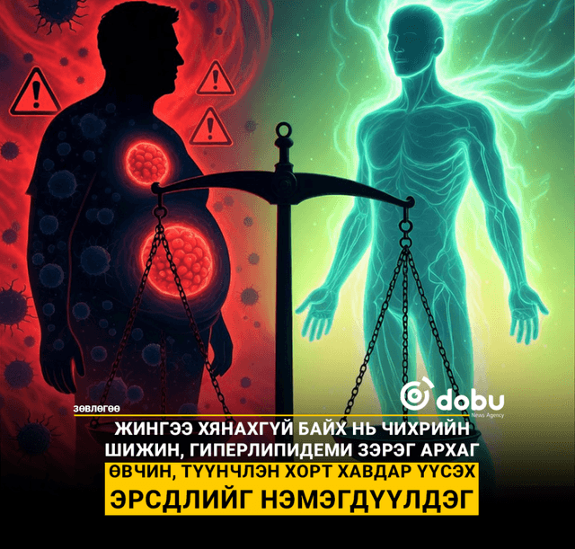 ЗӨВЛӨГӨӨ: Илүүдэл жингээ хасахгүй бол хорт хавдар тусах эрсдлийг нэмэгдүүлдэг