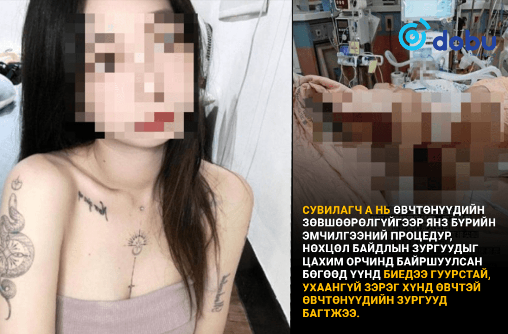 Сувилагч сэхээнд хүнд өвчтэй эмчлүүлж байгаа өвчтөнүүдийн зургийг цахим орчинд байршуулжээ