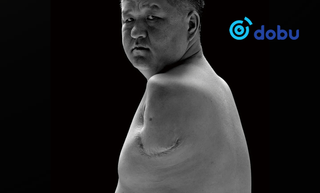 20,000 вольтын хүчдэлд хоёр гараа алдсан Монгол залуу