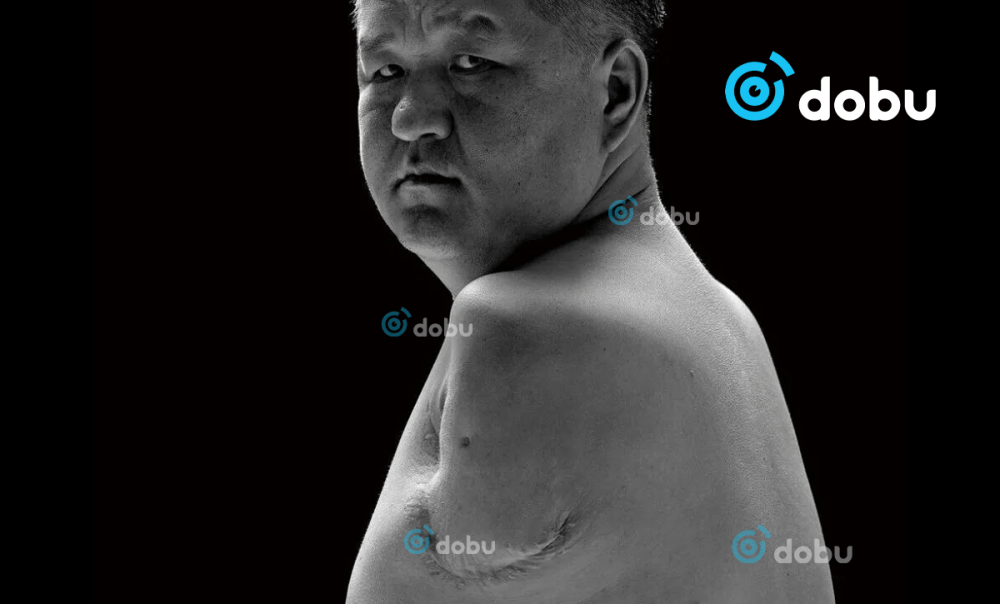 Хүний нутагт очоод хоёр гараа алдсан ч  хувь заяандаа нугараагүй Монгол залуугийн түүх