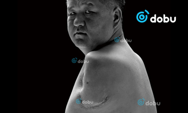 Хүний нутагт очоод хоёр гараа алдсан ч  хувь заяандаа нугараагүй Монгол залуугийн түүх