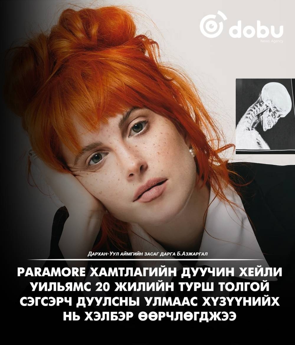 Paramore хамтлагийн дуучин Хейли Уильямс 20 жил толгойгоо сэгсэрч дуулсны улмаас хүзүүнийх нь хэлбэр өөрчлөгджээ