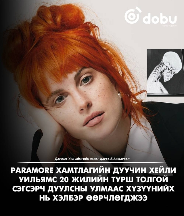 Paramore хамтлагийн дуучин Хейли Уильямс 20 жил толгойгоо сэгсэрч дуулсны улмаас хүзүүнийх нь хэлбэр өөрчлөгджээ