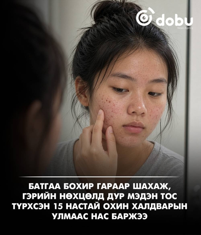 Батгаа бохир гараар шахаж, гэрийн нөхцөлд дур мэдэн тос түрхсэн 15 настай охин халдварын улмаас нас баржээ
