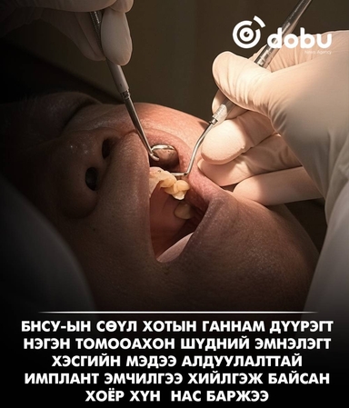 Сөүлд имплант эмчилгээ хийлгэж байсан хоёр хүн найман сарын зайтай нас баржээ