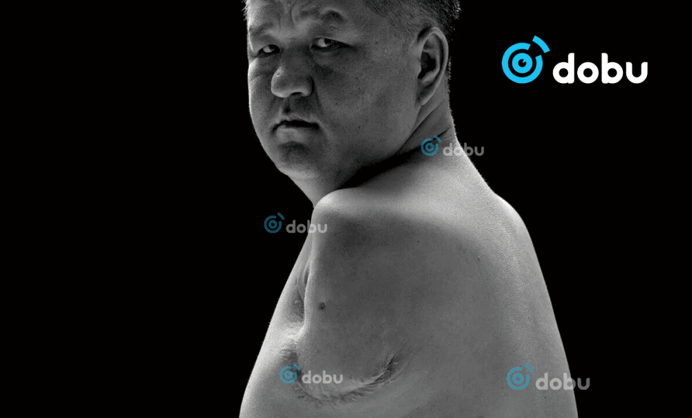 Хүний нутагт очоод хоёр гараа алдсан ч  хувь заяандаа нугараагүй Монгол залуугийн түүх