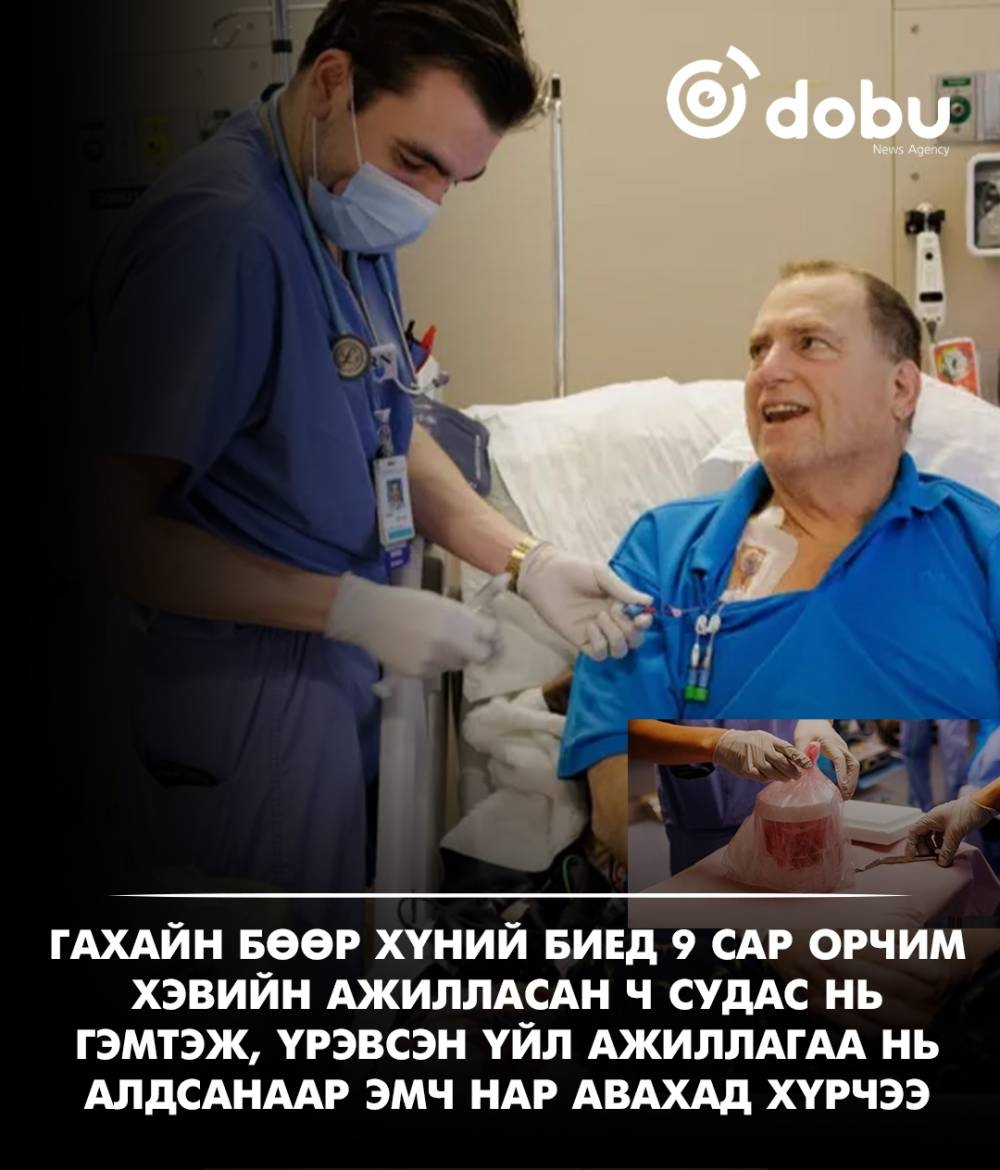 Гахайн бөөр хүний биед 9 сар орчим ажилласан ч сүүлдээ судас нь гэмтэж, үрэвсэн үйл ажиллагаа нь алдсанаар эмч нар авахад хүрчээ
